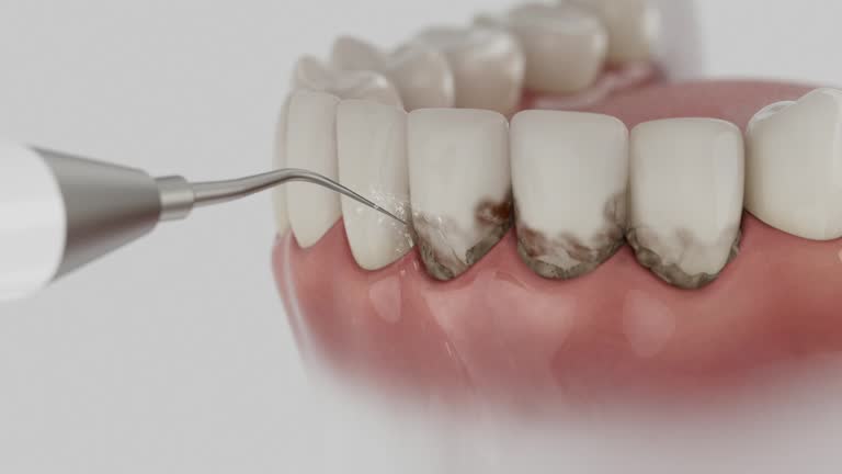 Trusted Root Canal Treatment service in East Franklin, NJ - Dentist Open Now